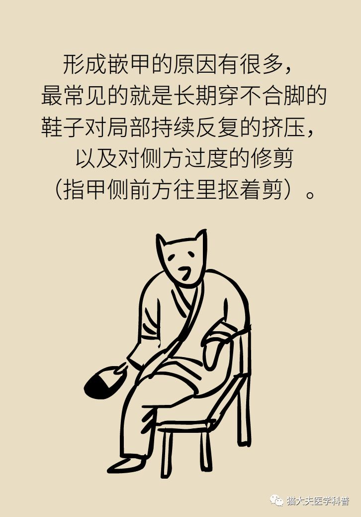 脚趾甲往肉里长怎么治除根,脚趾甲长在肉里面治疗视频