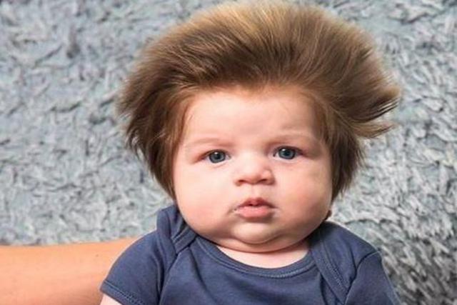 宝宝头发少怎么办才能长得好,宝宝头发稀少怎么打理