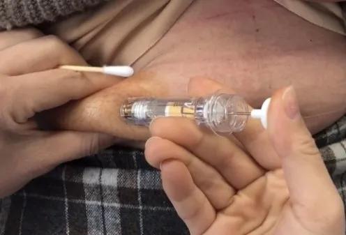 打皮下针拔针出血怎么办,皮下注射有回血继续注射会死吗