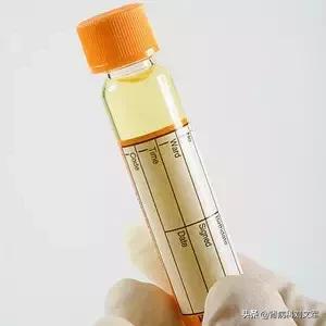 一分钟看懂尿常规化验单最全版,9秒钟带你看懂尿常规