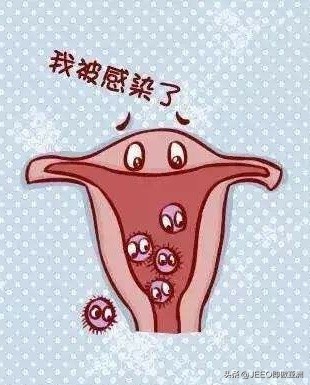 每日即傲——讲讲上环那些事