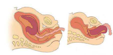探究分子在不断运动,探究分子间的作用力实验