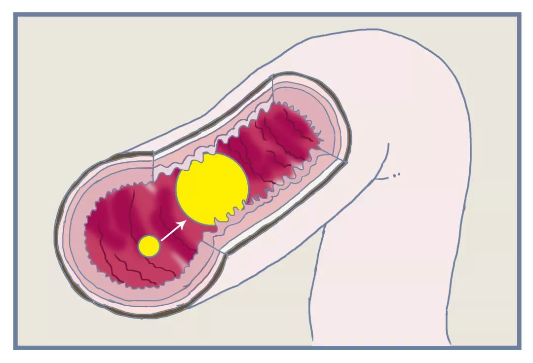 目前最前沿的便秘药,治便秘的药测评
