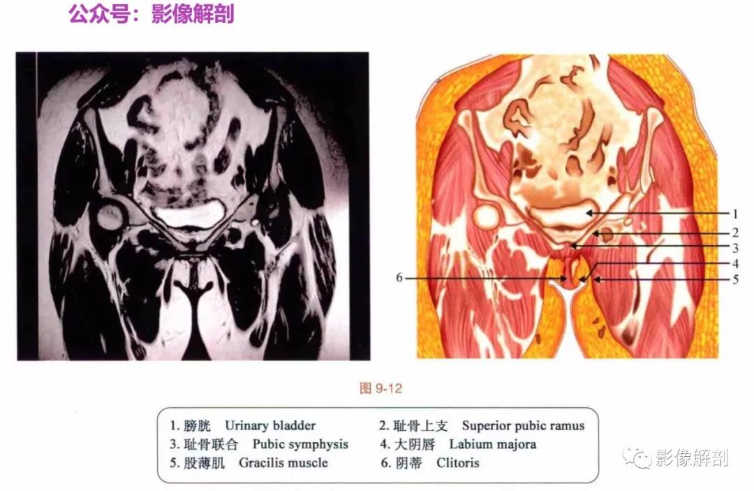 女性盆腔矢状位断层解剖,男性盆腔磁共振断层图谱