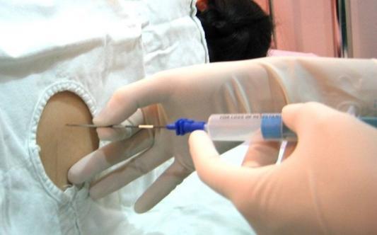 剖腹产拔尿管后怎么快速恢复排尿,剖腹产拔尿管怎么顺利排尿