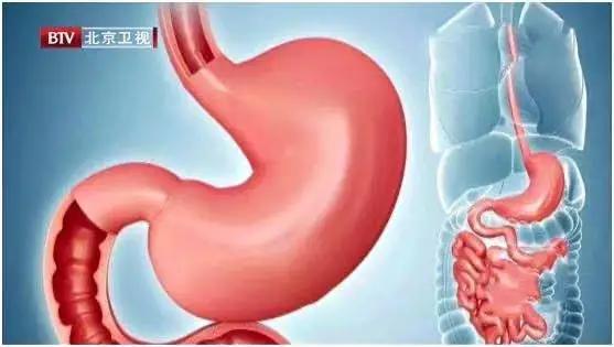 吃面养胃还是伤胃,吃面还是喝粥养胃