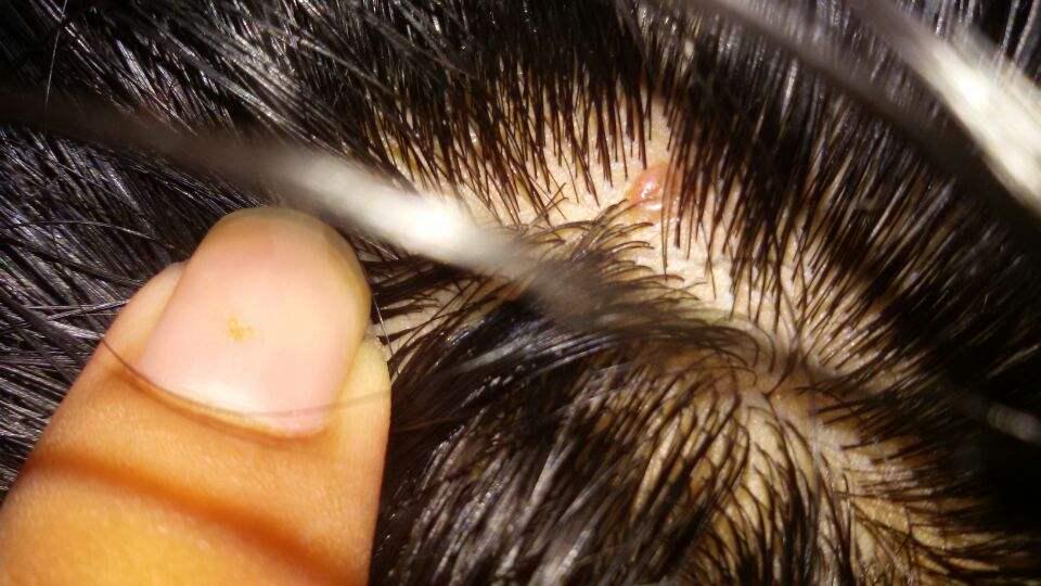 专治大油头的洗发露,拿什么洗发水拯救你的油头