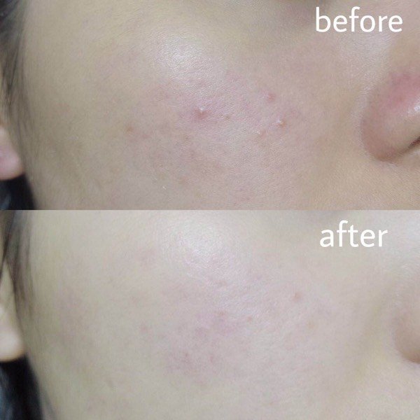 护肤小常识点赞,4个亲测护肤小妙招