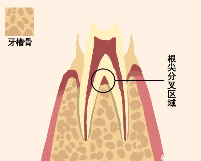 牙齿如何正确的脱落,一张动图告诉你