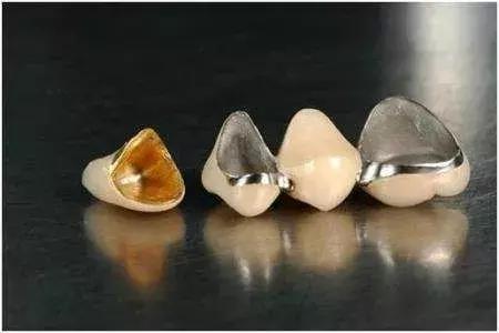 全瓷牙和烤瓷牙到底哪个好,烤瓷牙和全瓷牙优缺点及价格