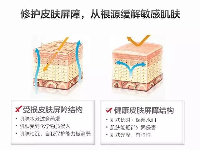 红血丝如何修复掌握四招轻松应对,有效消除红血丝
