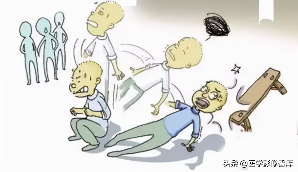 什么是眩晕的症状,什么是眩晕症图片