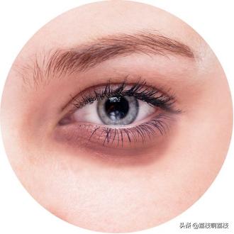 长期熬夜黑眼圈很重,长期熬夜导致的黑眼圈怎么办