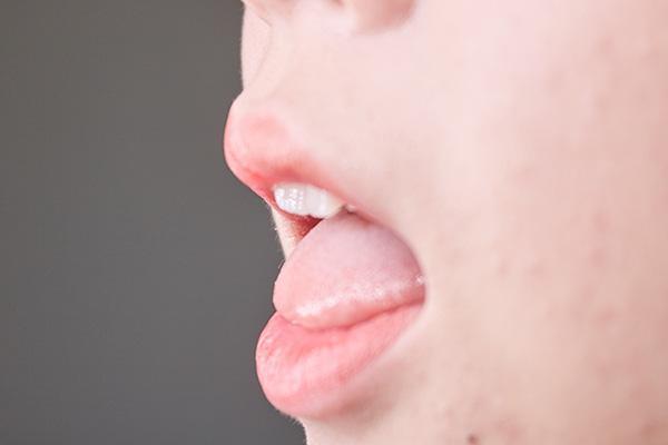 舌苔是健康“放大镜”，正常舌苔什么样？不同舌苔说明哪些问题？