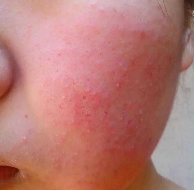 屈臣氏“断货王”，林志颖儿子一直在用的面霜，5秒卖出28000瓶