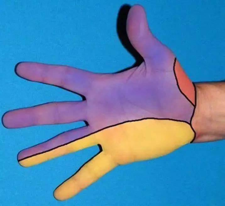 手麻就是颈椎病吗？有些病误诊后果很严重