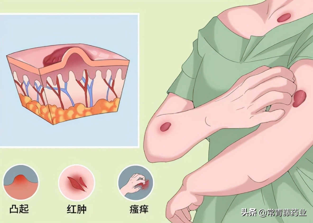 爱美之心,人皆有之,瘢痕的这些事是你想要知道的吗?