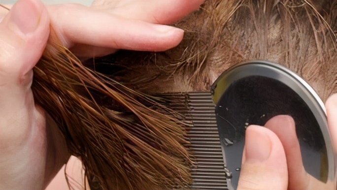 过度洗发会怎样,洗发水不适合会有什么症状