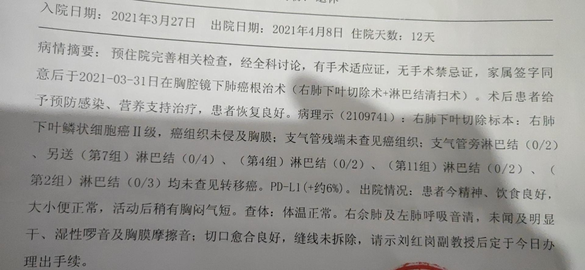 肺癌双肺弥漫转移生存期,肺结节小但是骨转移
