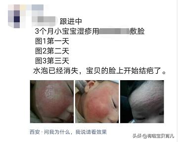 一般的湿疹膏,一擦就见效的护肤品打假