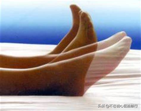 治疗腰椎间盘突出的方法与思路,腰椎间盘突出腰腿酸痛多久能好