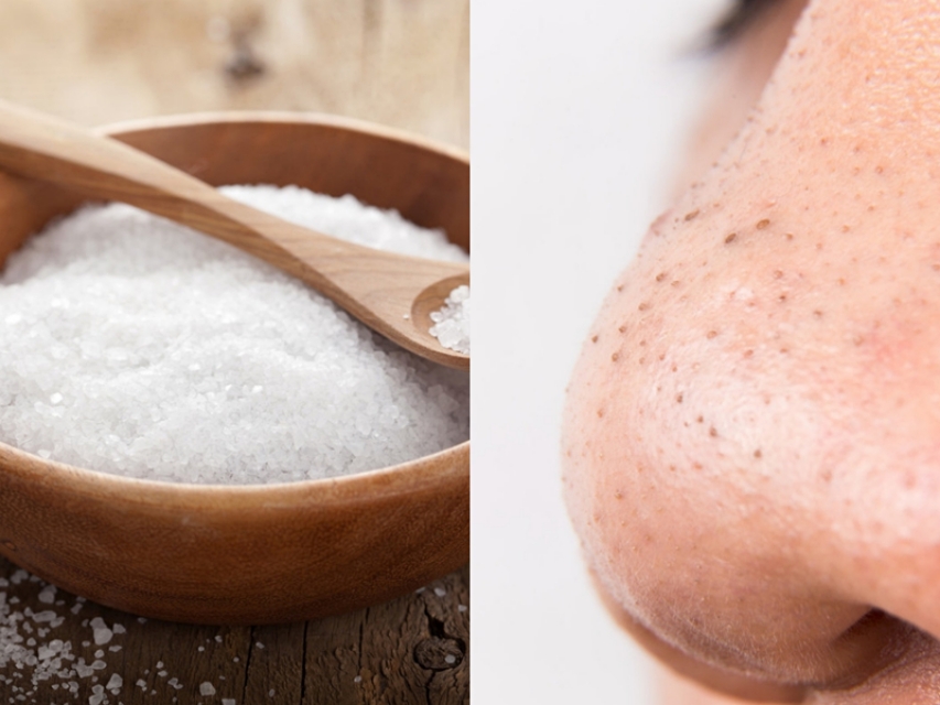 去黑头方法白泥,去黑头土方法用绳子