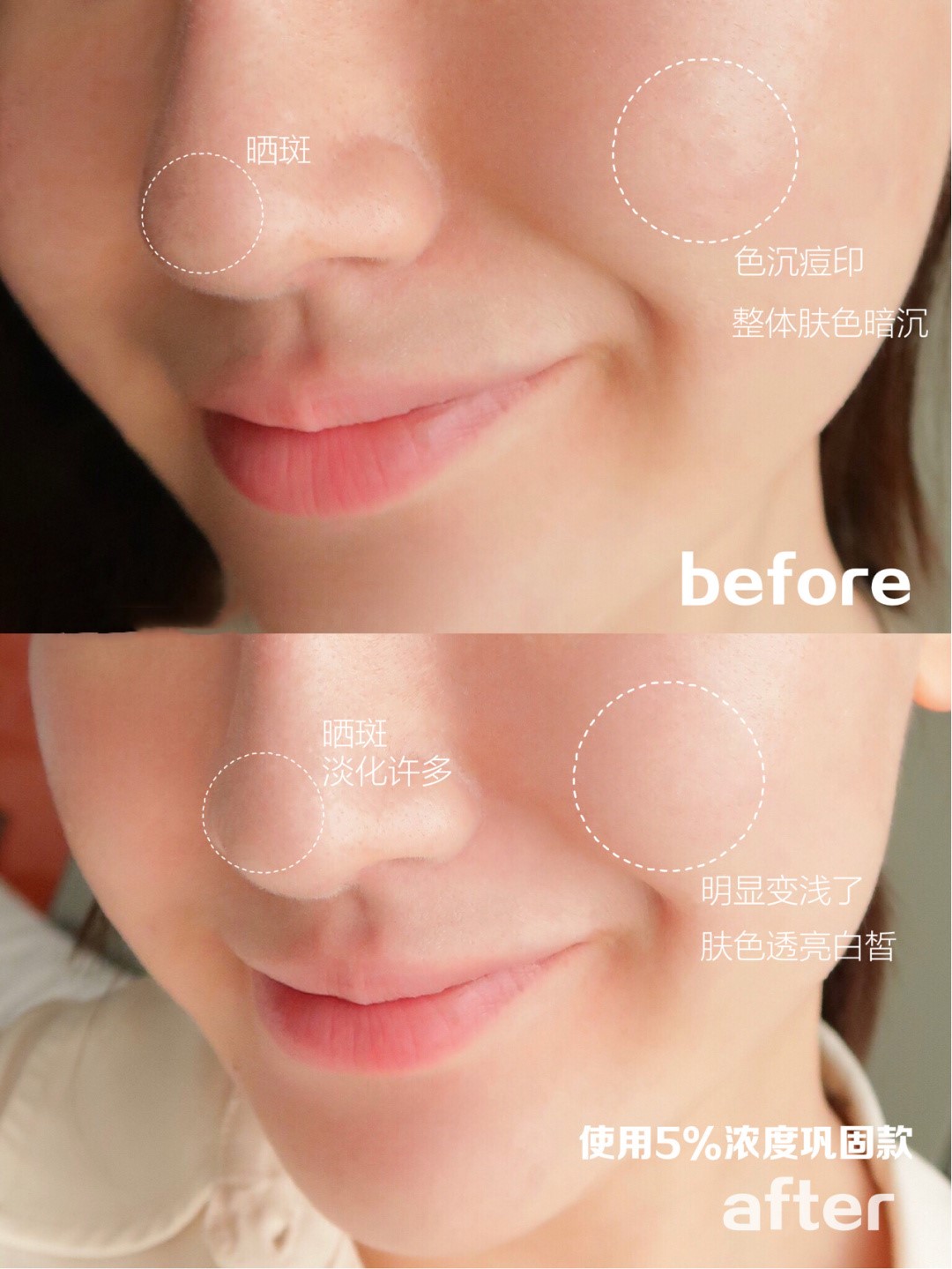 2023大牌精华液抗皱紧致抗衰老,500元以内最好用的精华