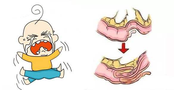 8个月宝宝身上味道很难闻,八个月女宝下部有异味