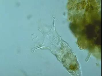 污泥镜检操作方法,污泥检测项目及标准有哪些呢