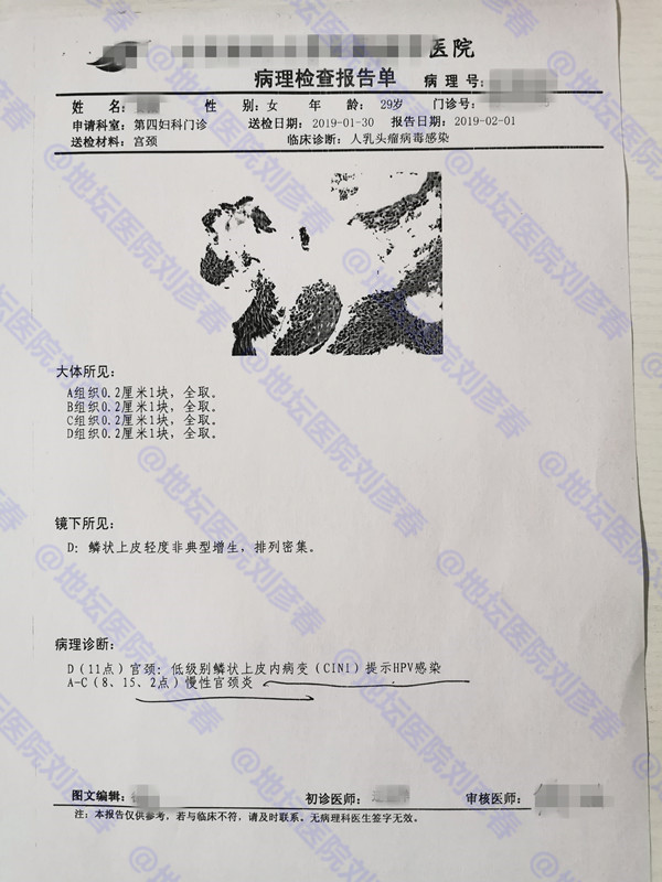 宫颈病变干扰素多久能见效,宫颈干扰素副作用及后遗症