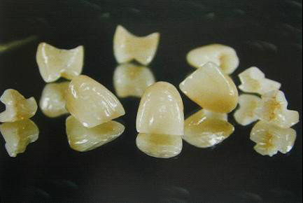 各类假牙价格,最便宜的假牙多少钱一颗