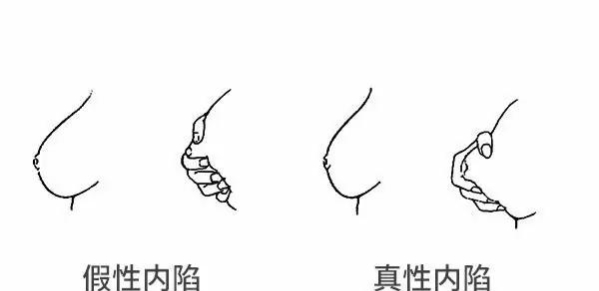 准妈妈生宝宝,准妈妈快要生的前兆