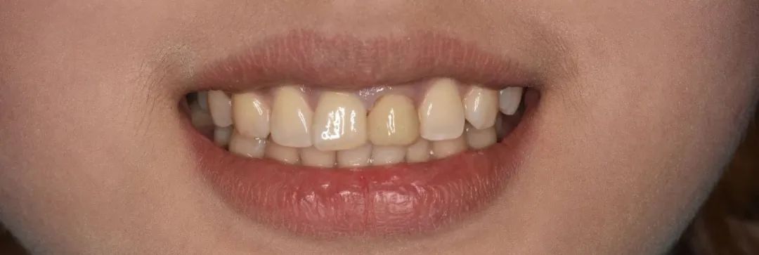 口腔牙医感言,牙医从业感悟