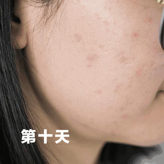 清洁毛孔的洁面皂,保持洗完脸的面部透亮