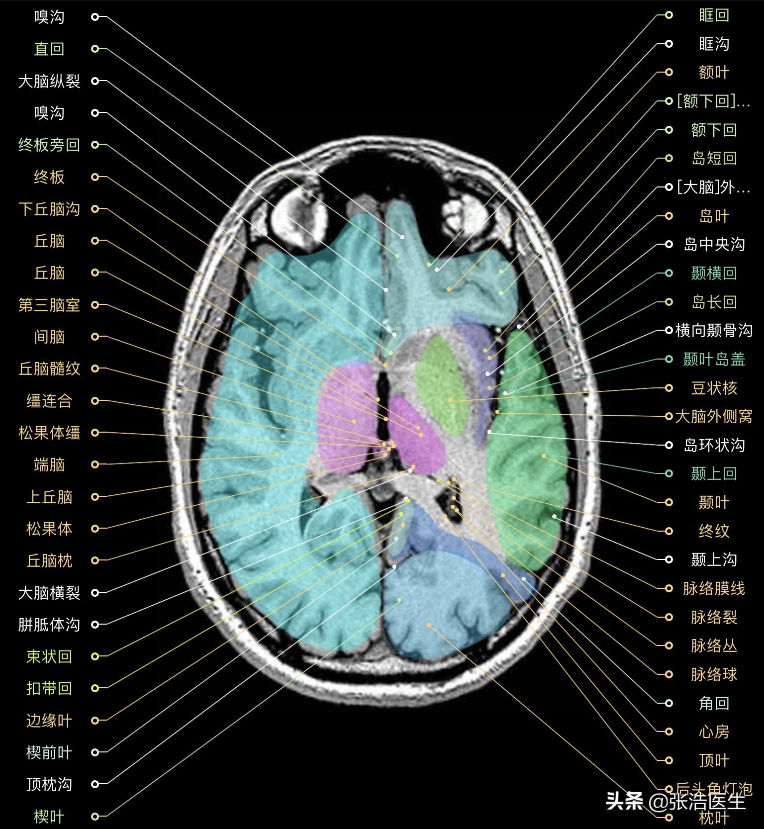 颅脑mri断层解剖视频课件,颅脑mri解剖手绘图