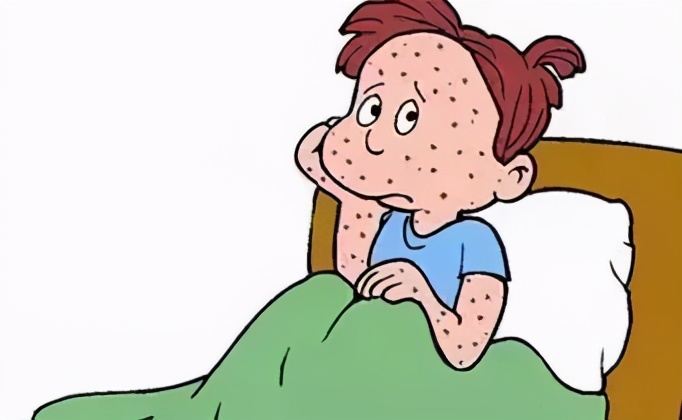小孩长水痘怎么办,中学生水痘自愈的最快方法