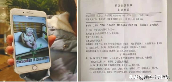 小儿推拿是忽悠还是真有效,最近火热的小儿推拿真的那么好吗