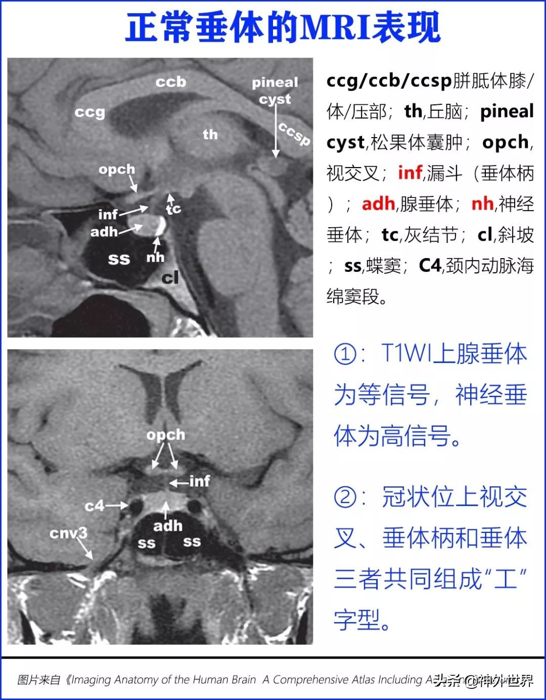 鞍区解剖学习笔记之——垂体