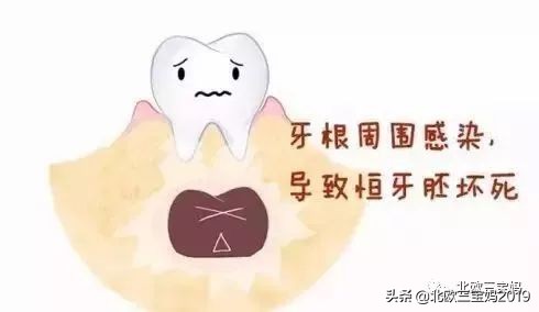 5岁小孩打全麻治蛀牙有影响吗,3岁孩子全麻风险大吗