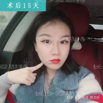 哪些人群不适合做热玛吉?