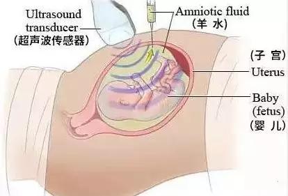 子宫壁薄不易怀孕,子宫壁太薄怀不上孩子原理