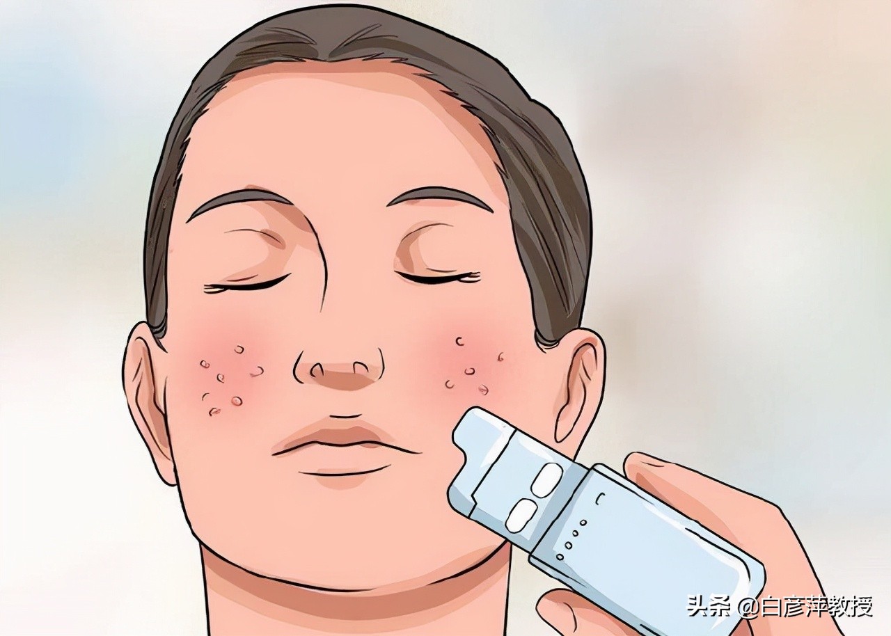 湿疹是什么原因造成的湿疹怎么治,肛周湿疹其他部位也有湿疹怎么办