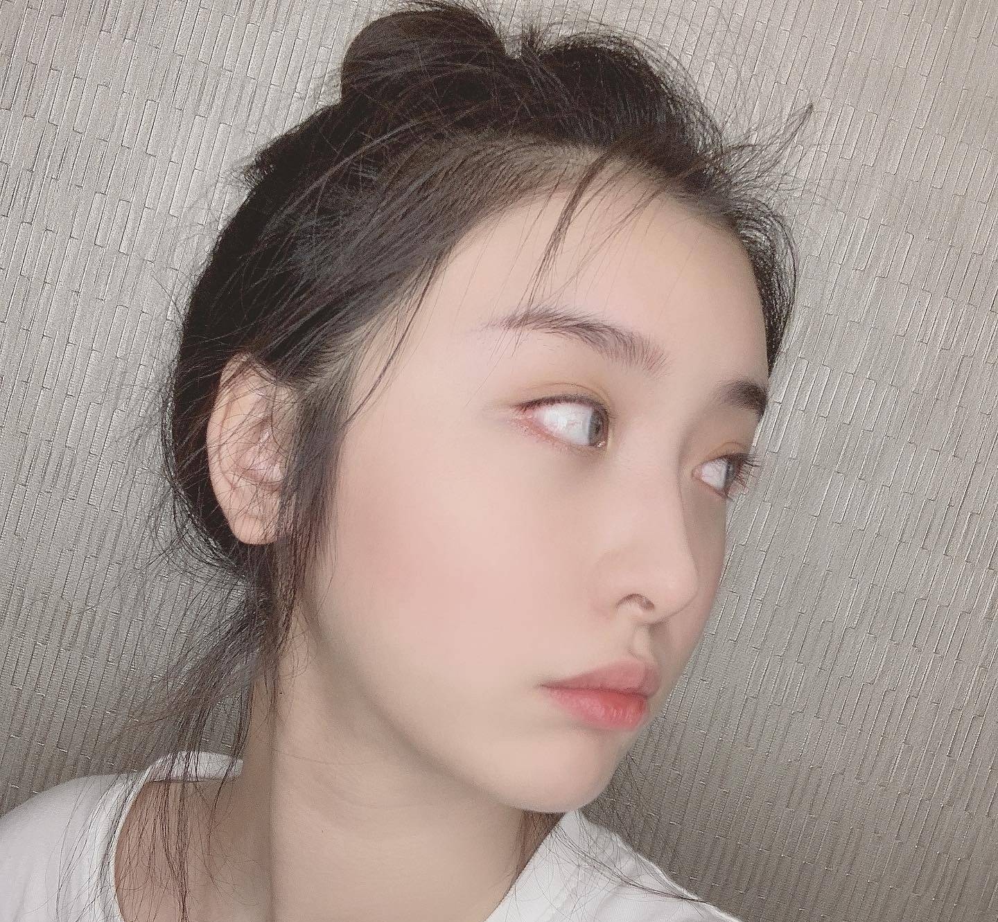 颅顶高低所带来的危害,颅顶低怎么矫正