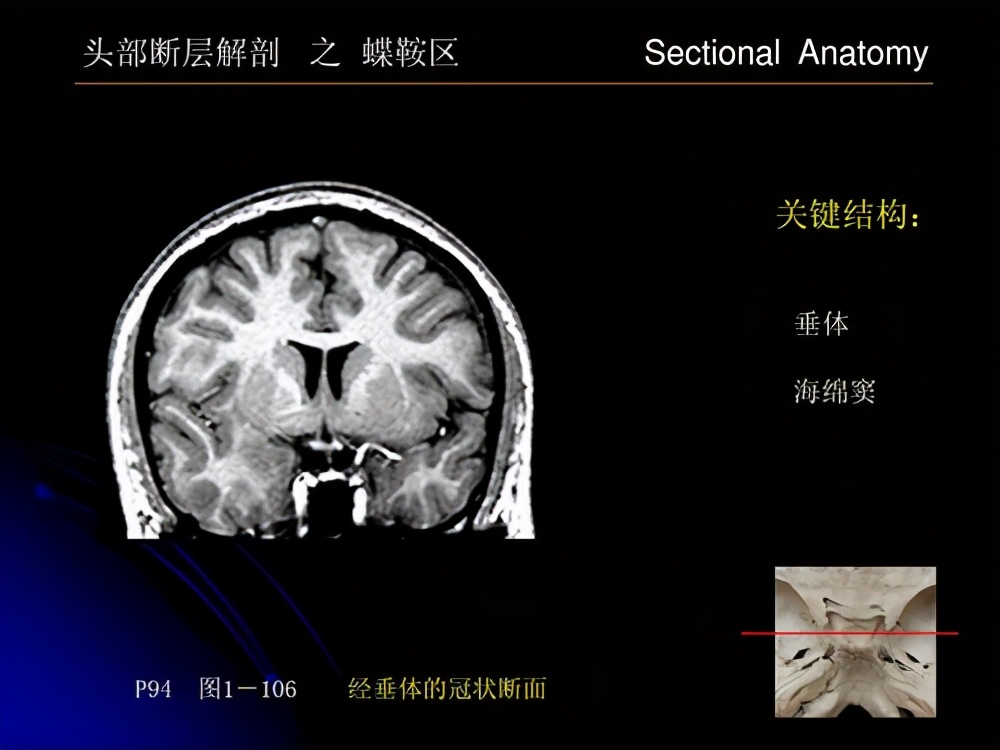 泌乳素瘤不来月经子宫会萎缩吗,绝经后泌乳素瘤用治疗吗
