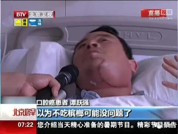 槟榔是不是禁止打广告了,槟榔为什么不允许打广告