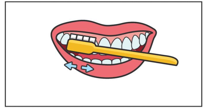 孩子龋齿怎么干预和治疗,小孩子治疗龋齿最好的药