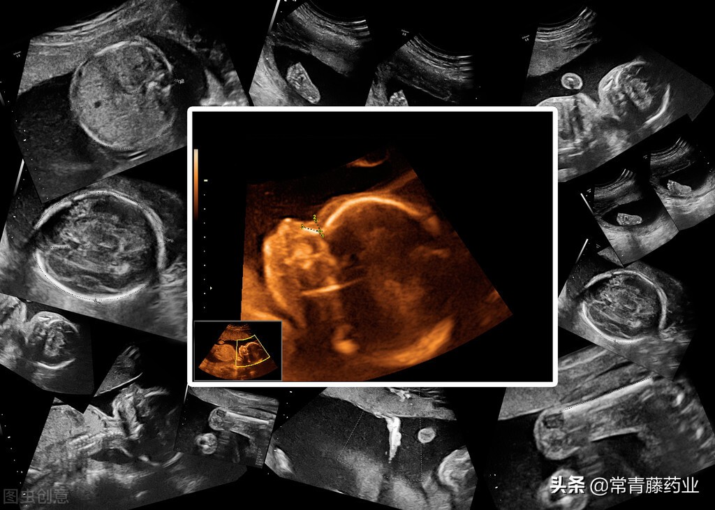 流产吃药安全吗,药物流产药剂量大的危害