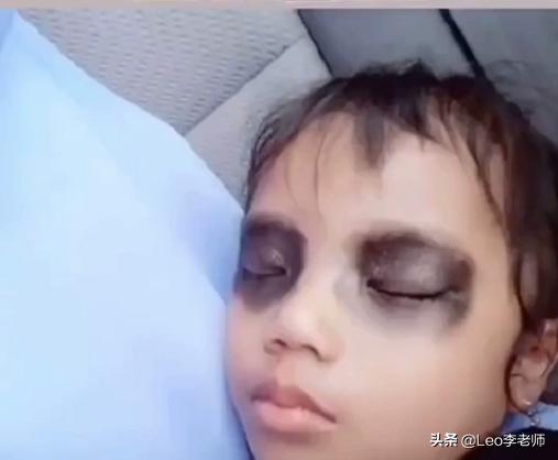 把孩子眼周围涂上眼影,制止孩子看手机给孩子眼睛画眼影