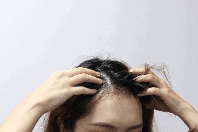 头发爱出油用什么可以变蓬松,头发油怎么才能头发蓬松干爽