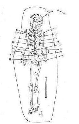 零口姑娘的悲惨下场,零口姑娘死因揭秘